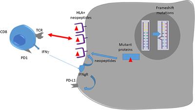 Is There a Place for Immunotherapy for Metastatic Microsatellite Stable Colorectal Cancer?